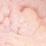 Flux Crawl Amaco Crawls Glaze Flux Crawl Amaco Crawls Glaze